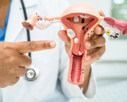 Hysterectomy